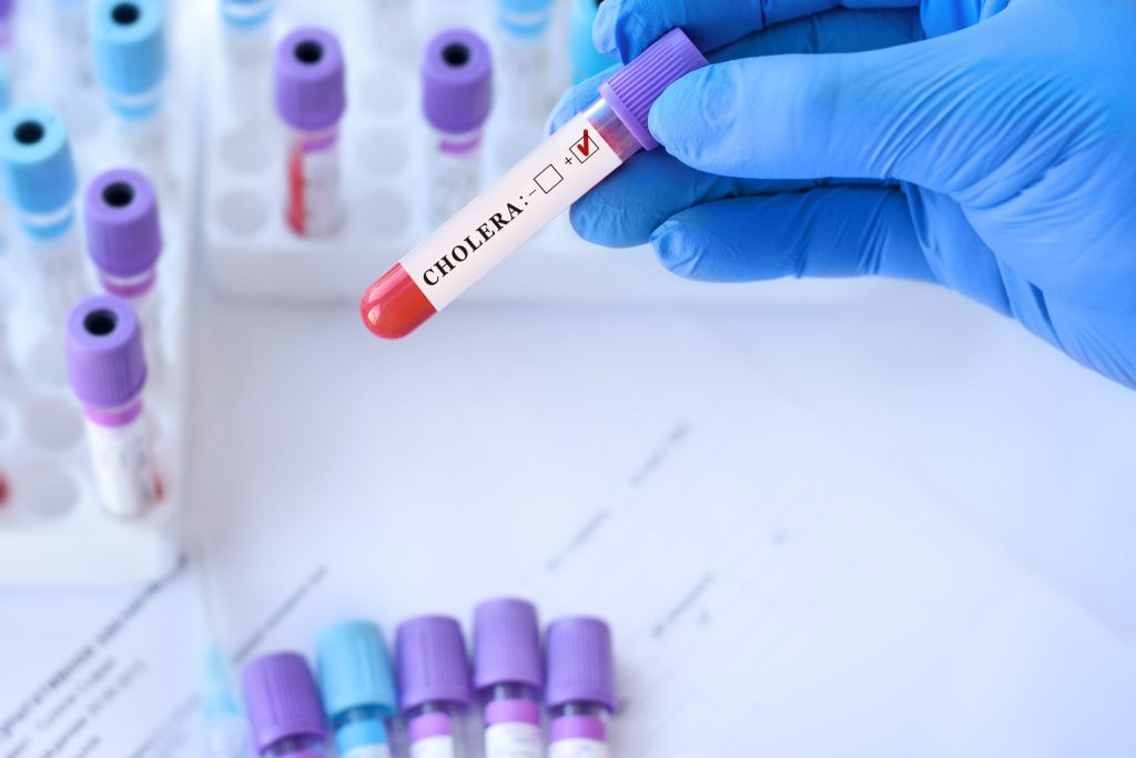COLERA-03-1024x683 El cólera repunta en el mundo: alerta por el impacto en la salud pública de Perú y Sudamérica